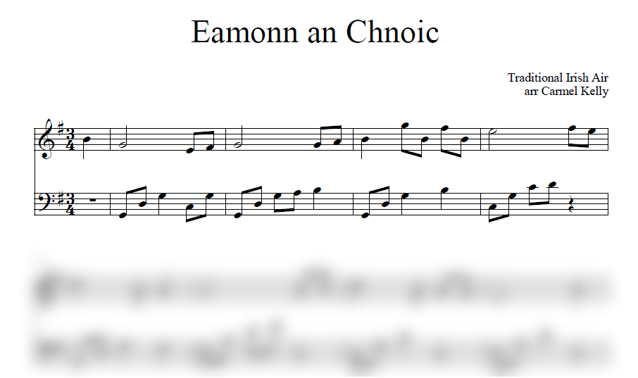Eamonn an Chnoic CD Image